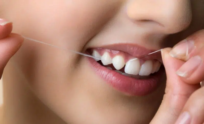 Cara Menghilangkan Gigi Kuning dengan Cepat dan Aman